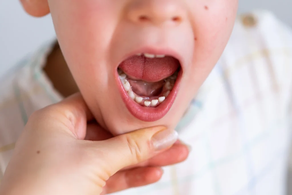 do baby teeth have stem cells | Little Smiles of Beverly Hills