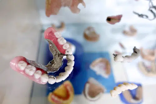 Pediatric zirconia crowns in Beverly Hills by Dr. Sepehr Nassiripour, DDS