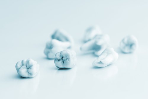 Tooth-colored fillings in Beverly Hills by Dr. Sepehr Nassiripour, DDS