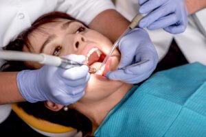 Sealants: The Invisible Shield Against Cavities