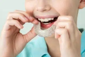 kids invisalign