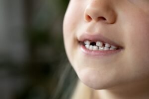 child gum disease symptoms