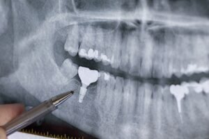 digital x-ray safety