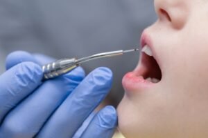 Frenectomy Recovery Guide for Parents